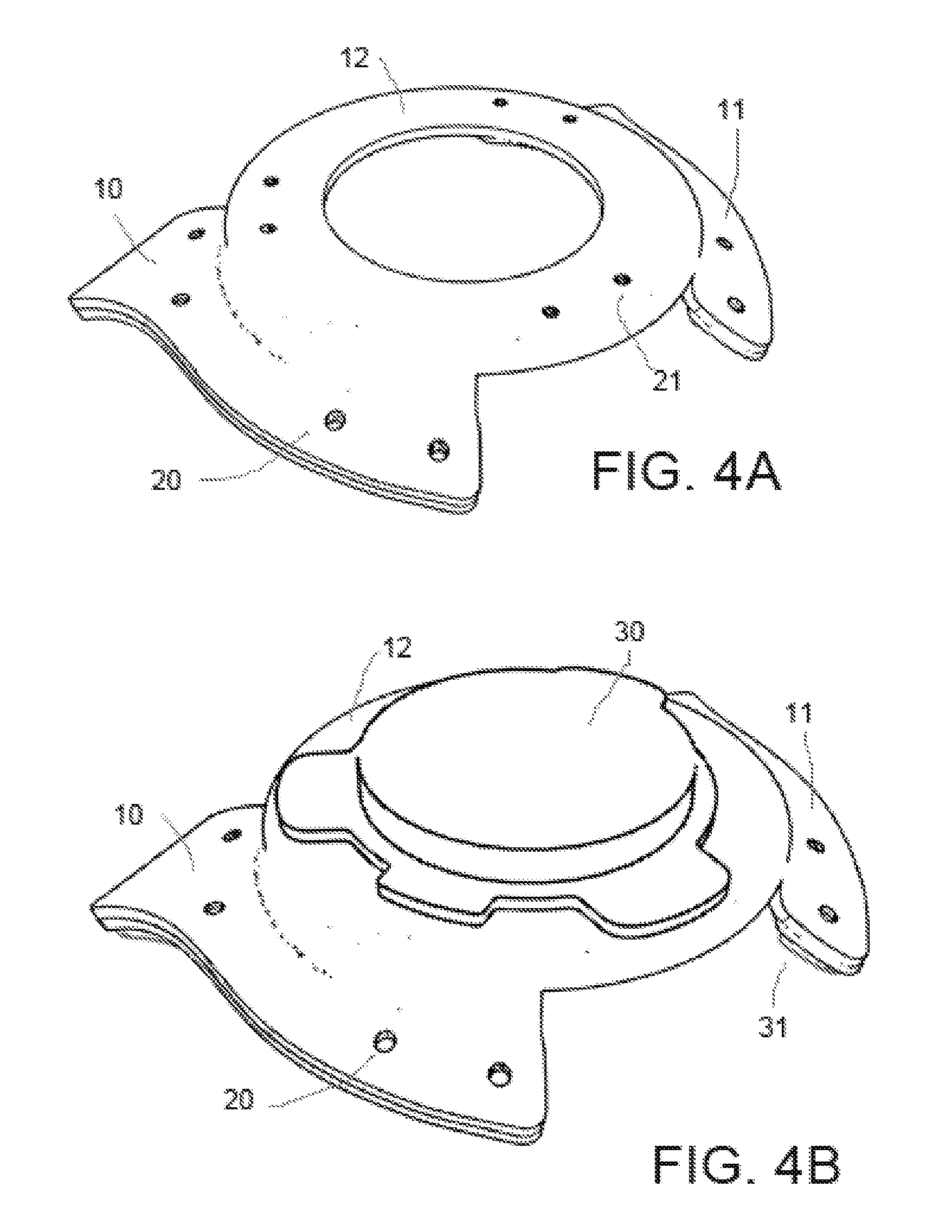 Rigid fixture for coupling one or more transducers to the upper back of the human body