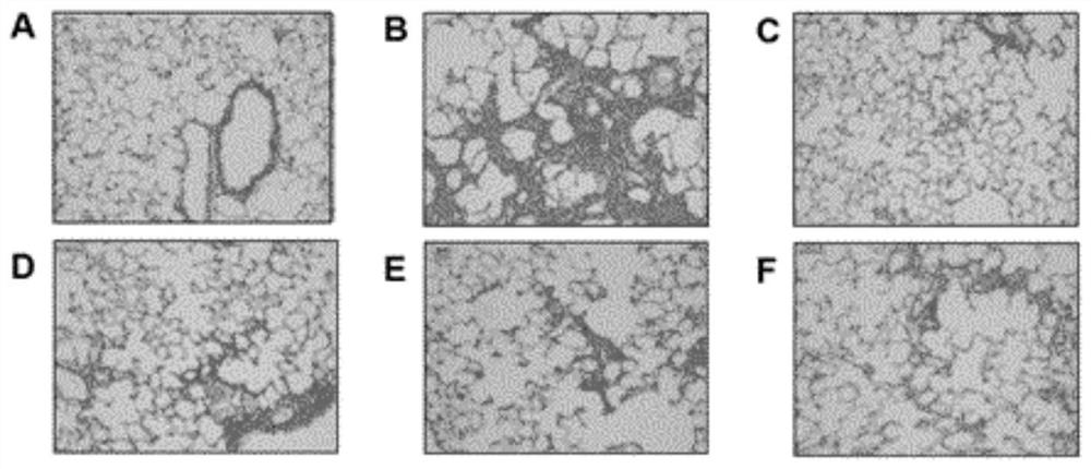 Lung-heat-clearing pharmaceutical composition and preparation method thereof