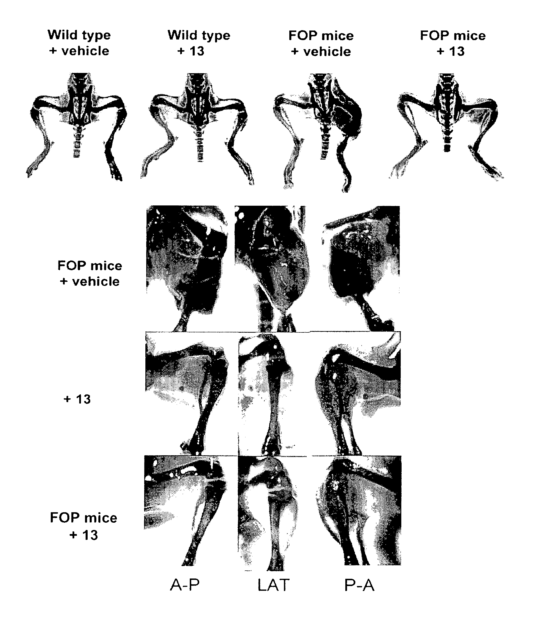 Inhibitors of the bmp signaling pathway