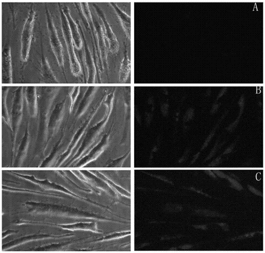 A kind of chitosan carries siRNA coating vascular stent and preparation method thereof