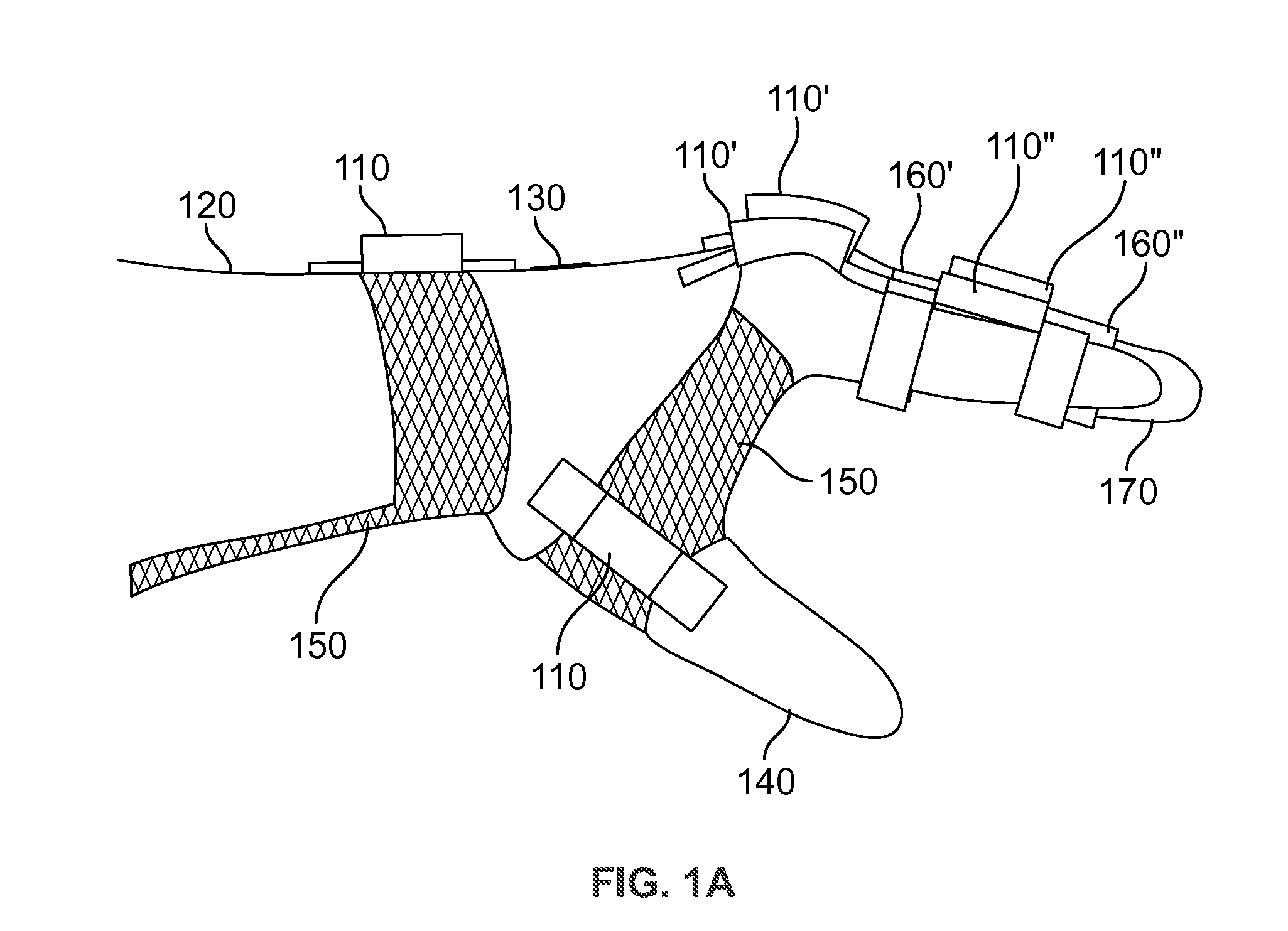 Myoelectric hand orthosis