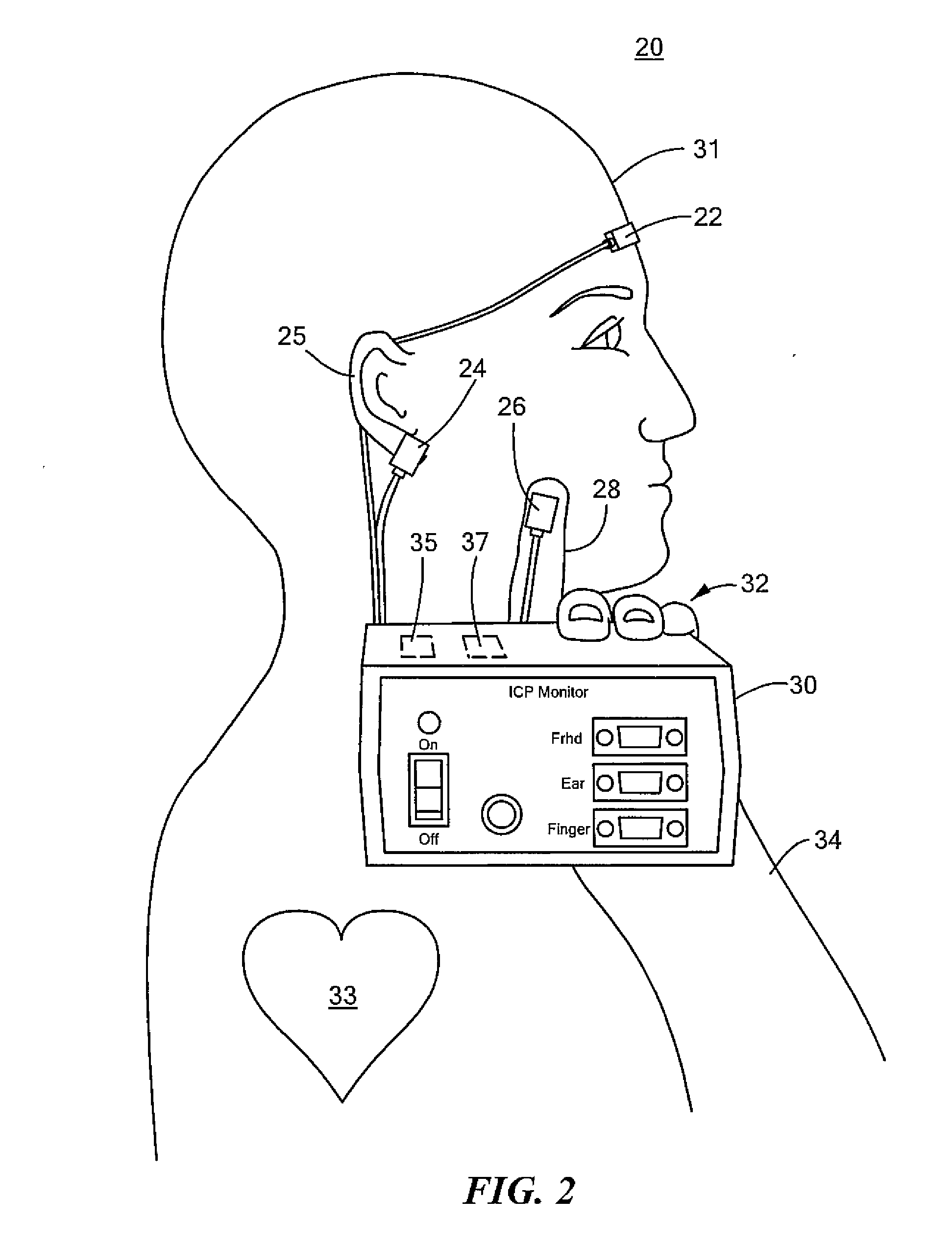 Non-invasive intracranial pressure monitoring system and method thereof