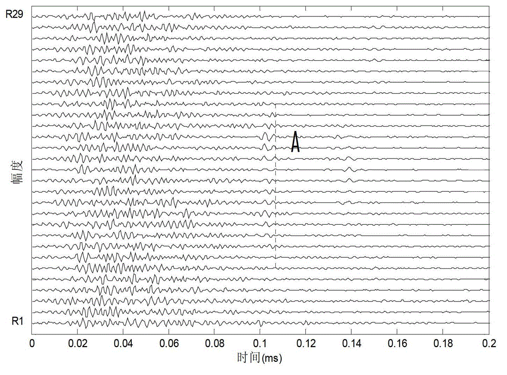 Defect detecting method of concrete