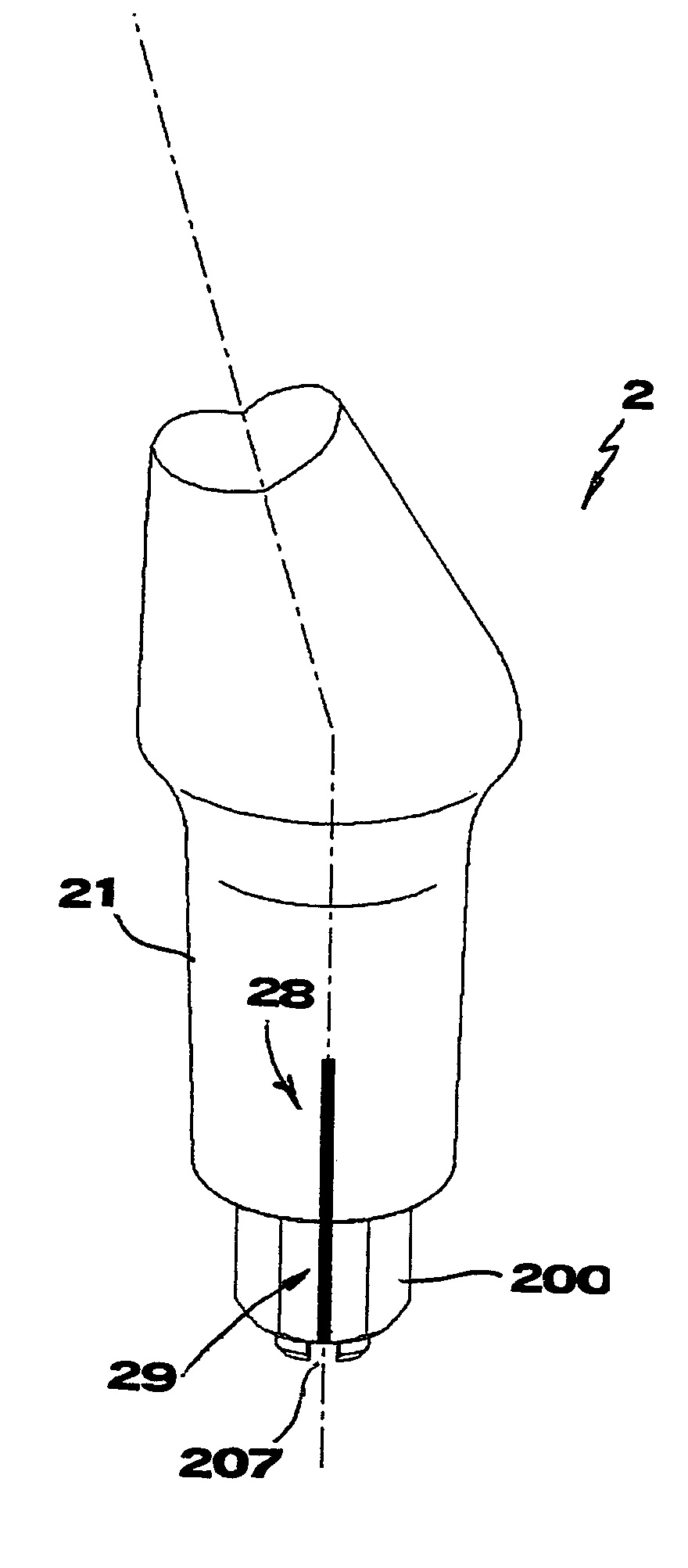 Dental implant