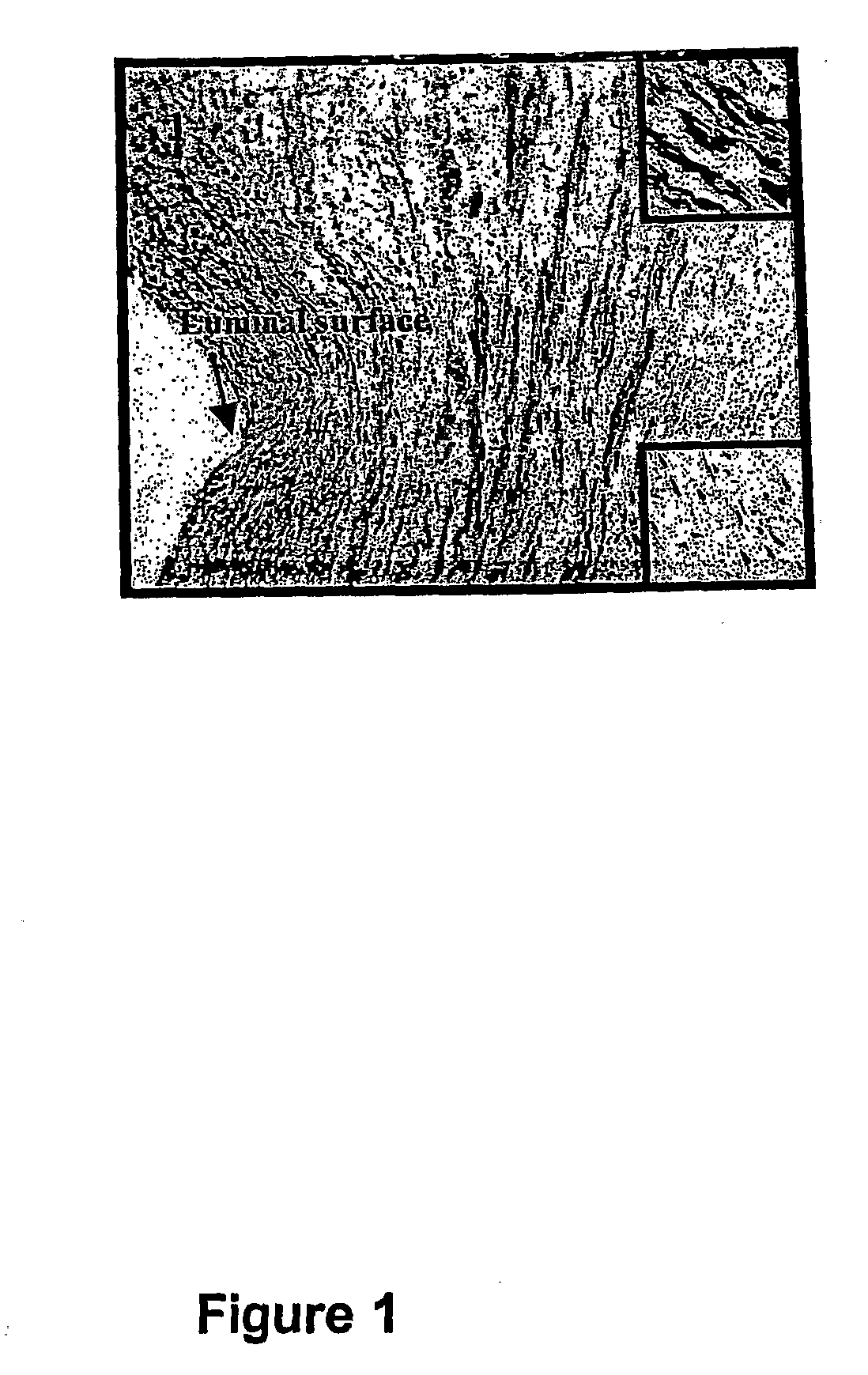 Methods And Compositions For The Treatment Of Graft Failure