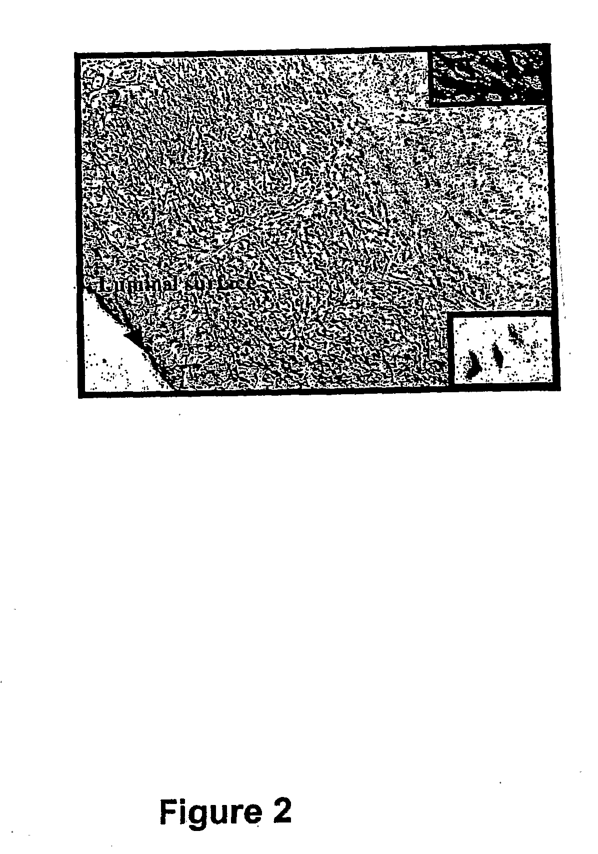 Methods And Compositions For The Treatment Of Graft Failure