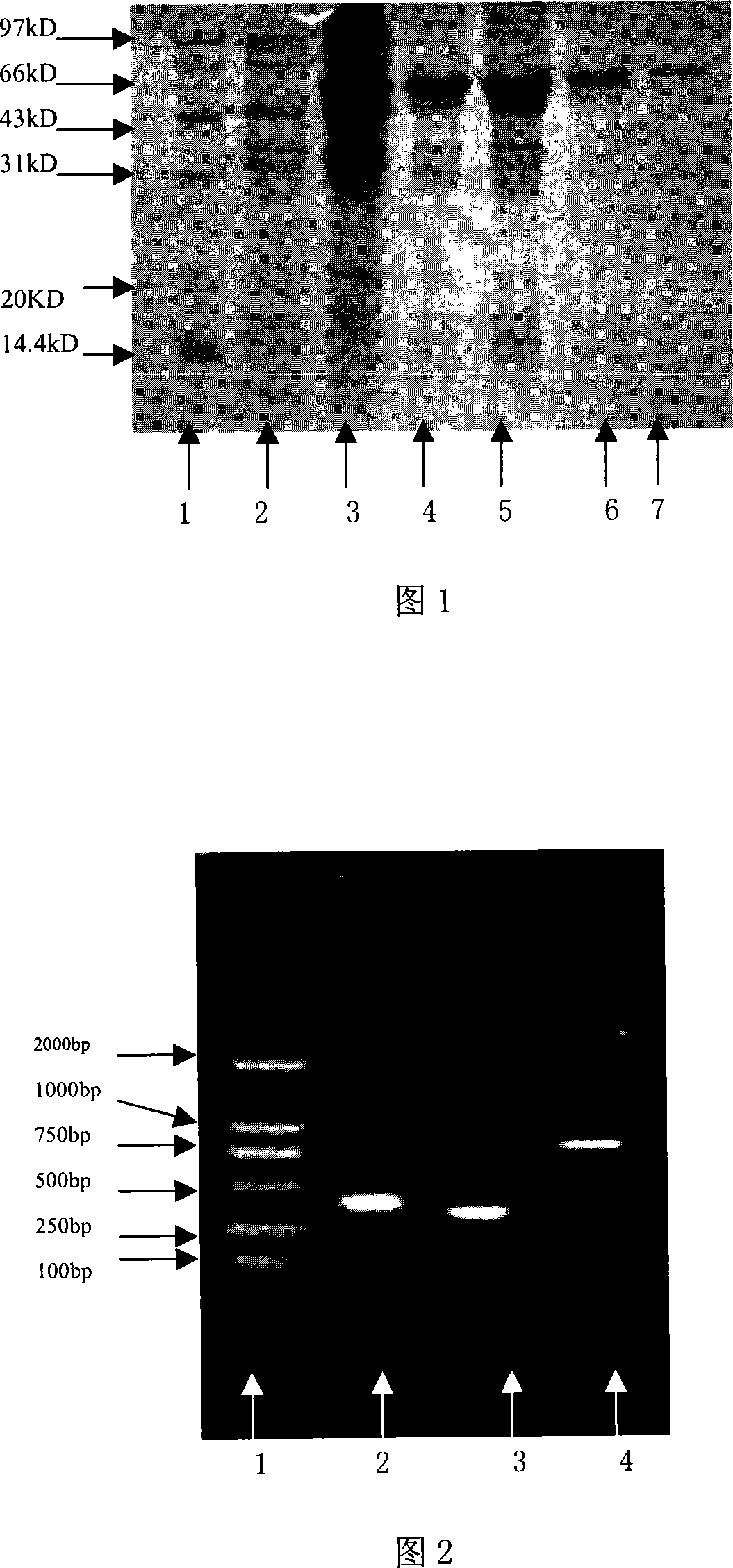 Anti-HER2 single-chain antibody-cefuroxime sodium enhanced fusion protein HER2(Fv-LDM)