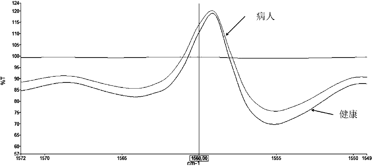 Biological molecule detecting method based on optical comb coherent imaging analysis