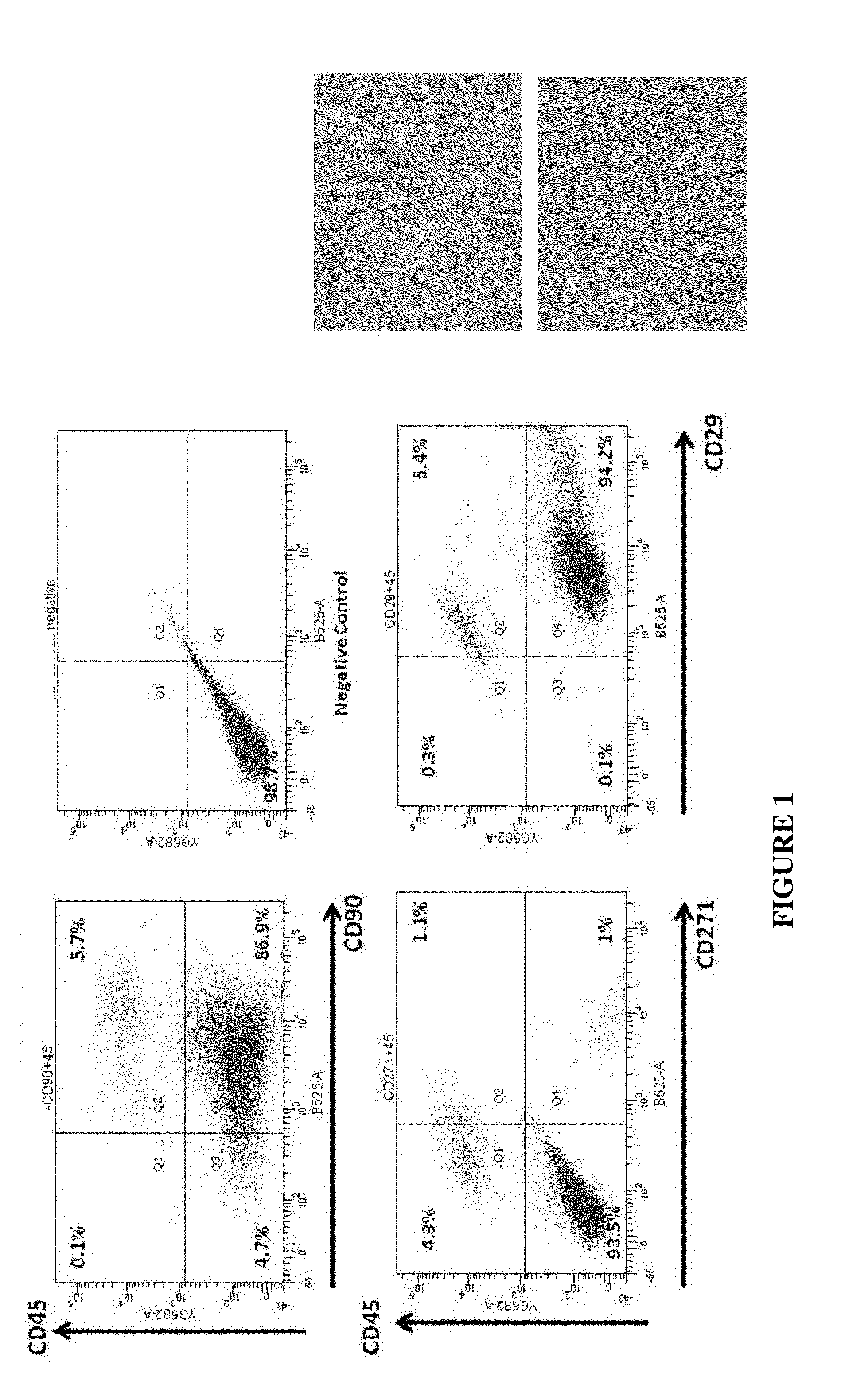 Treatment of Urinary Incontinence with Regenerative Glue