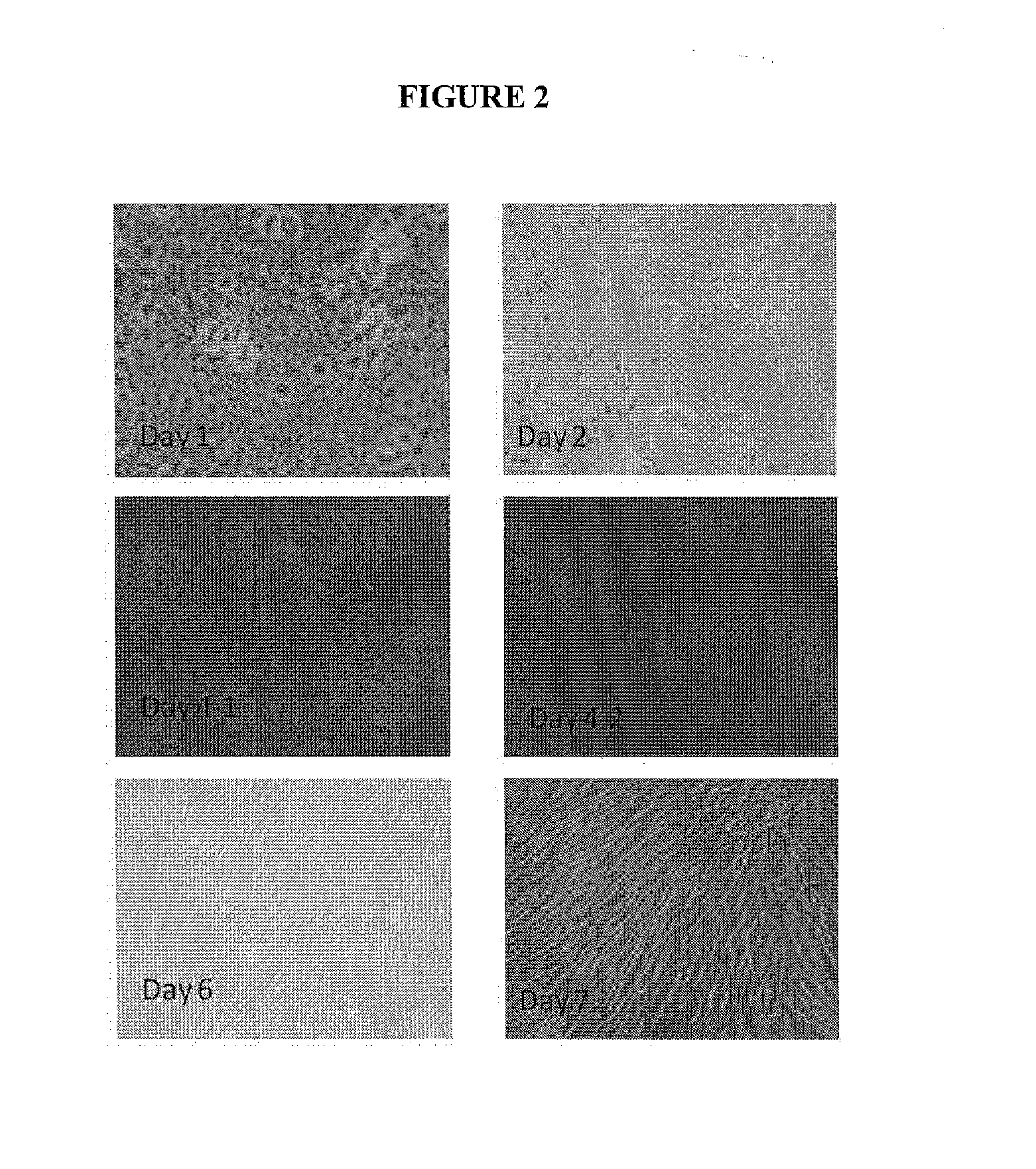 Treatment of Urinary Incontinence with Regenerative Glue