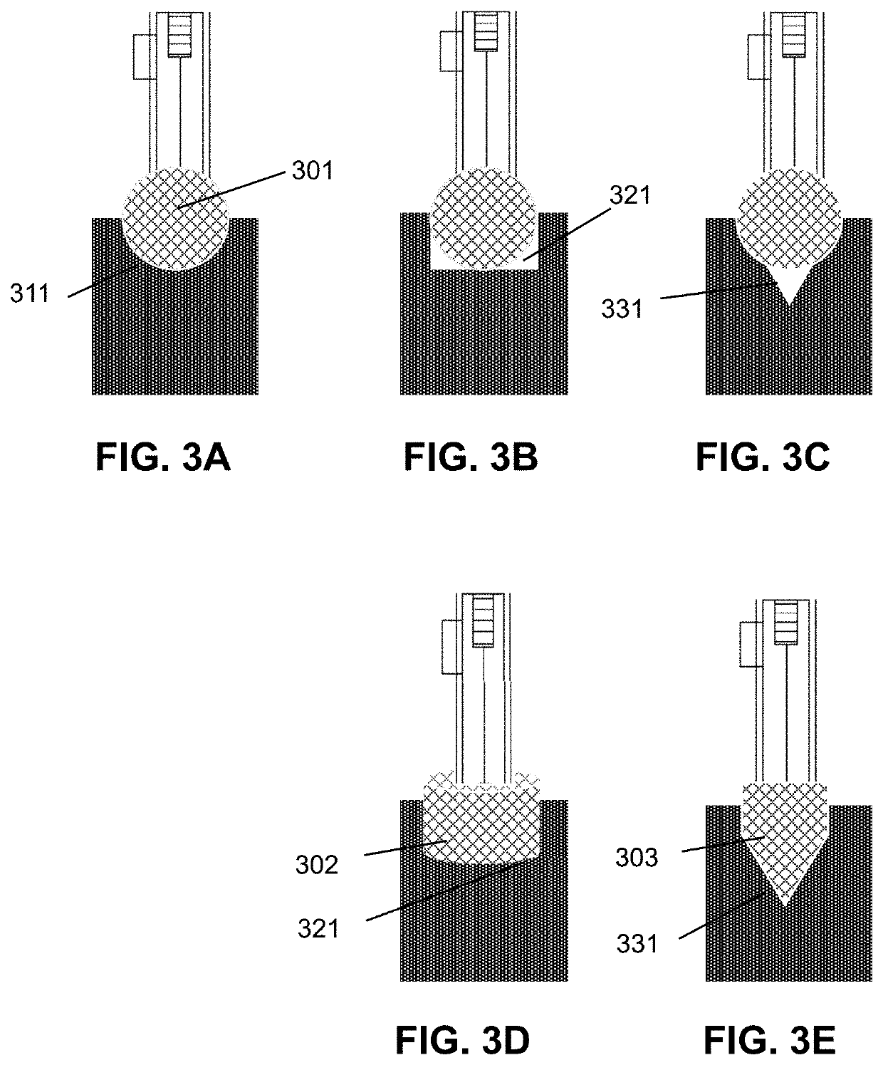 Cavitary tissue ablation