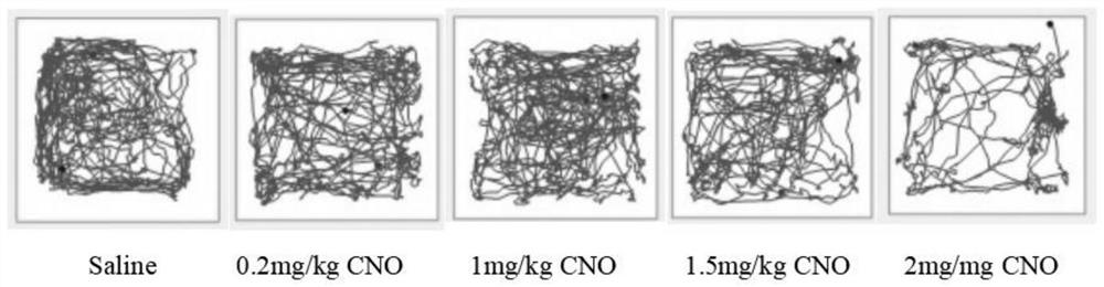 Application of N-clozapine oxide in preparation of medicine for preventing and treating nitrogen anesthesia