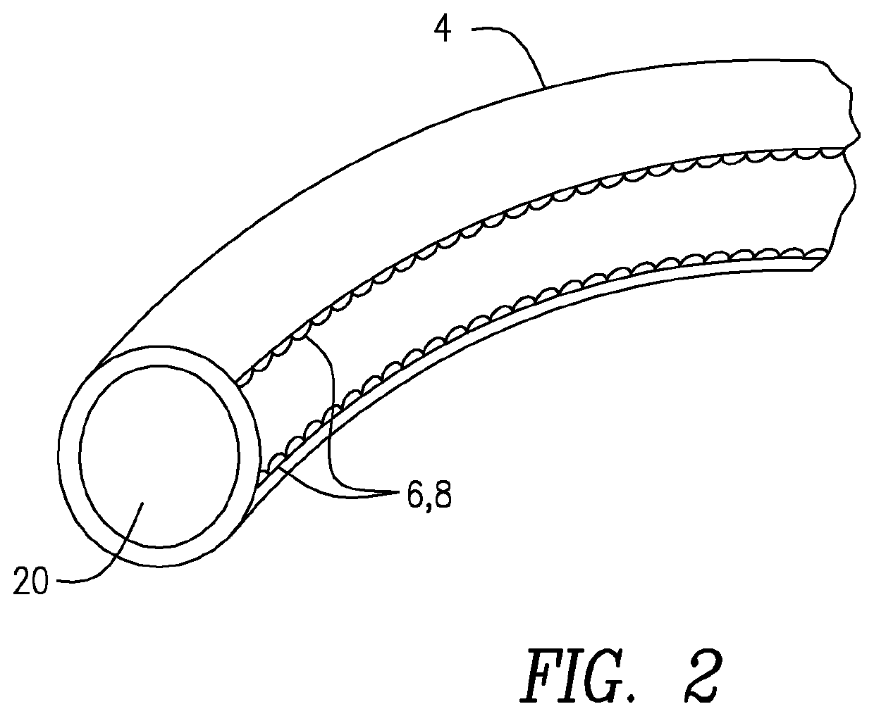 Steering wheel cover