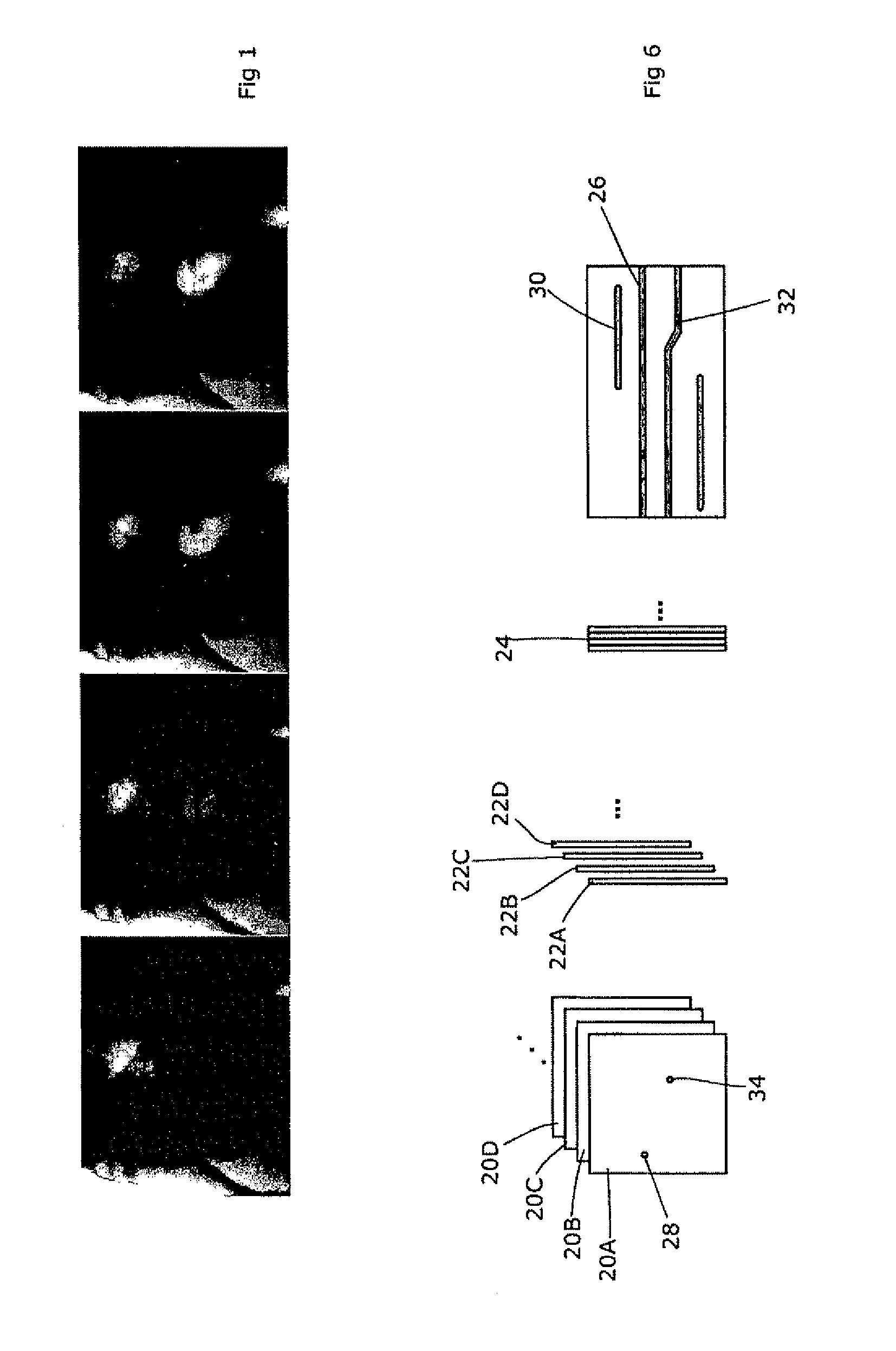 Motion artefact reduction in CT scanning