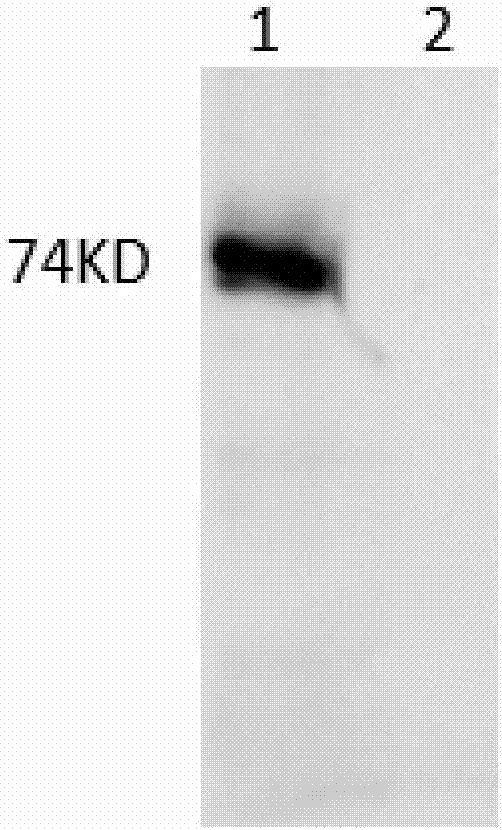 Anti-Ebola virus GP protein monoclonal antibody, and applications thereof