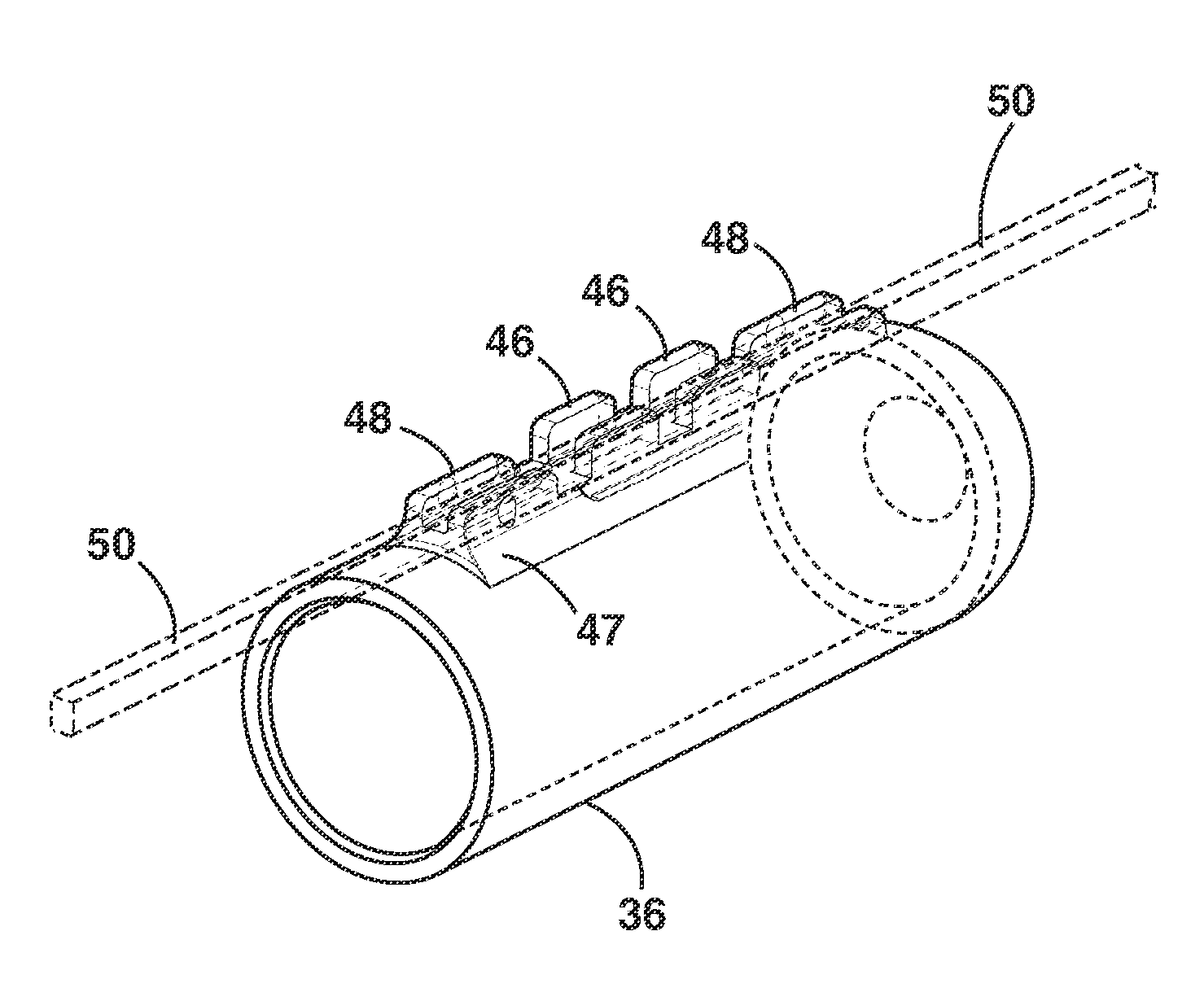 Implantable Medical Sensor and Fixation System