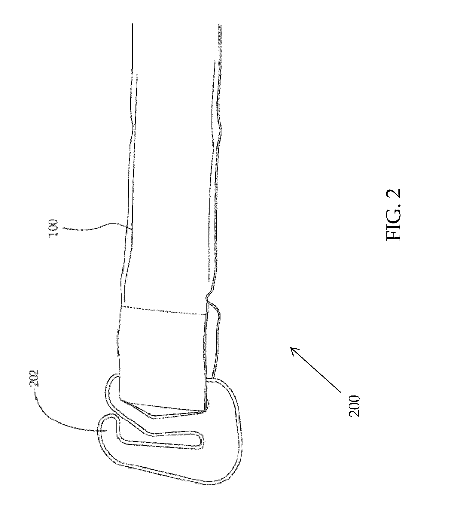 Apparatus and method for window treatment management