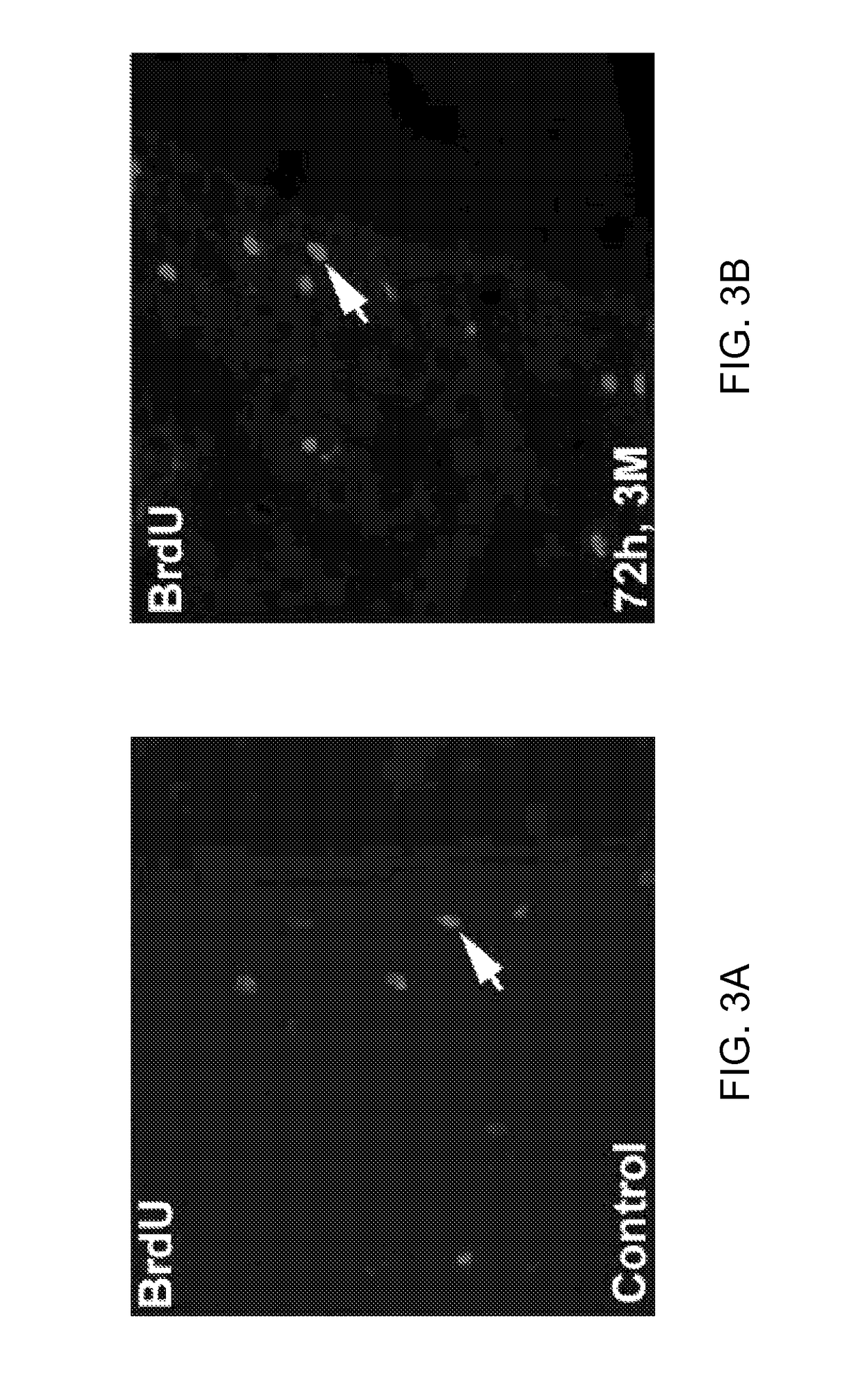 Treatment of neurological injury by administration of human umbilical cord tissue-derived cells