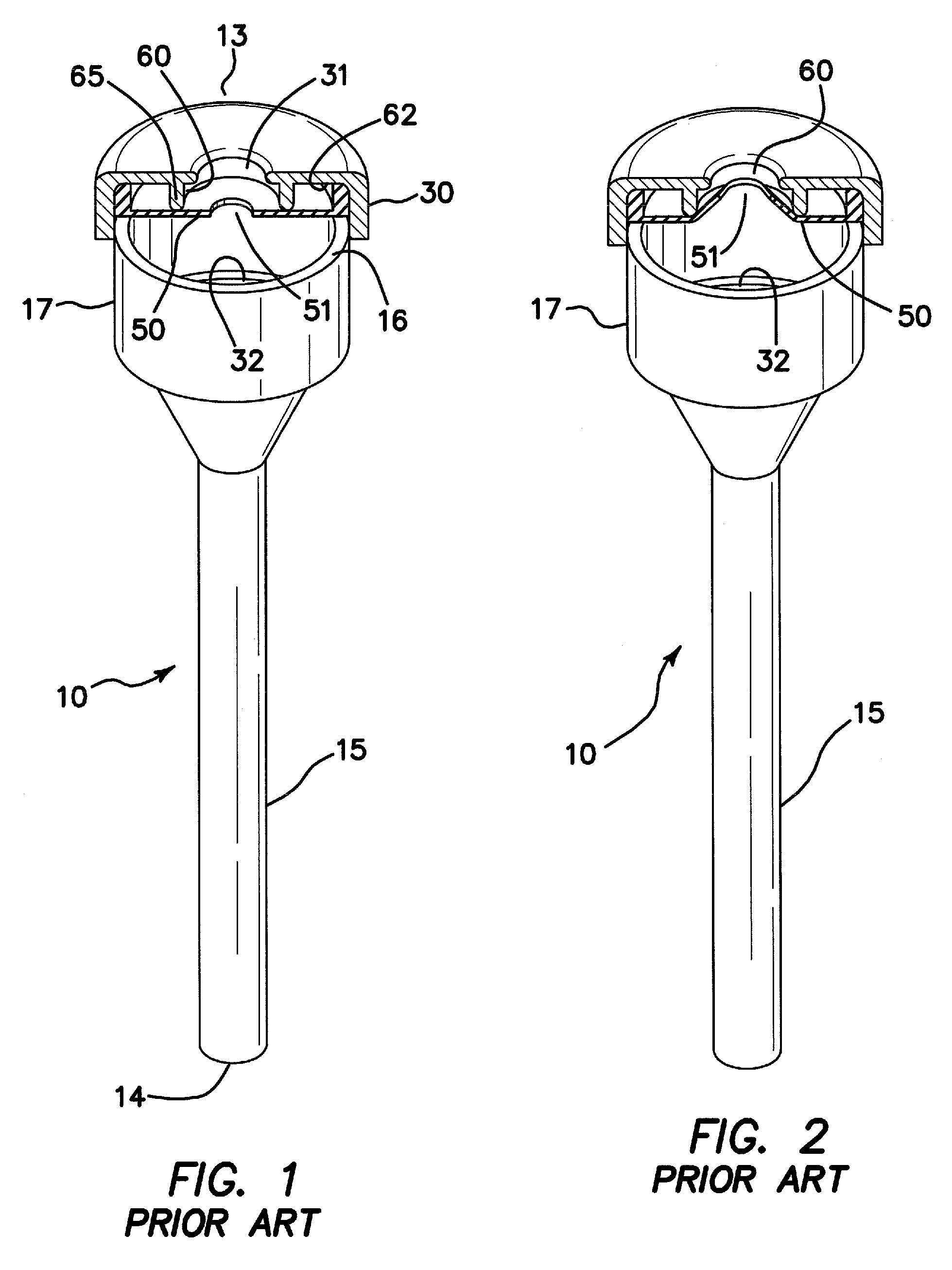 Seal housing having anti-inversion features