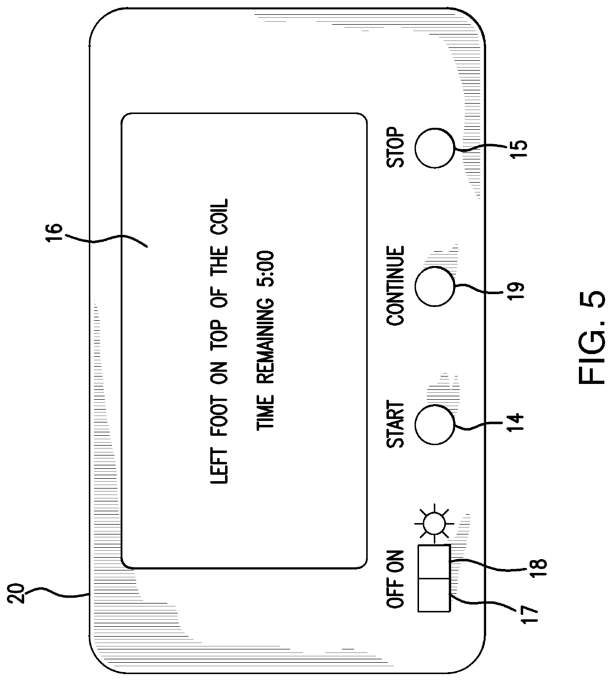 Integrated magnetic pulsation device for the treatment of foot pain