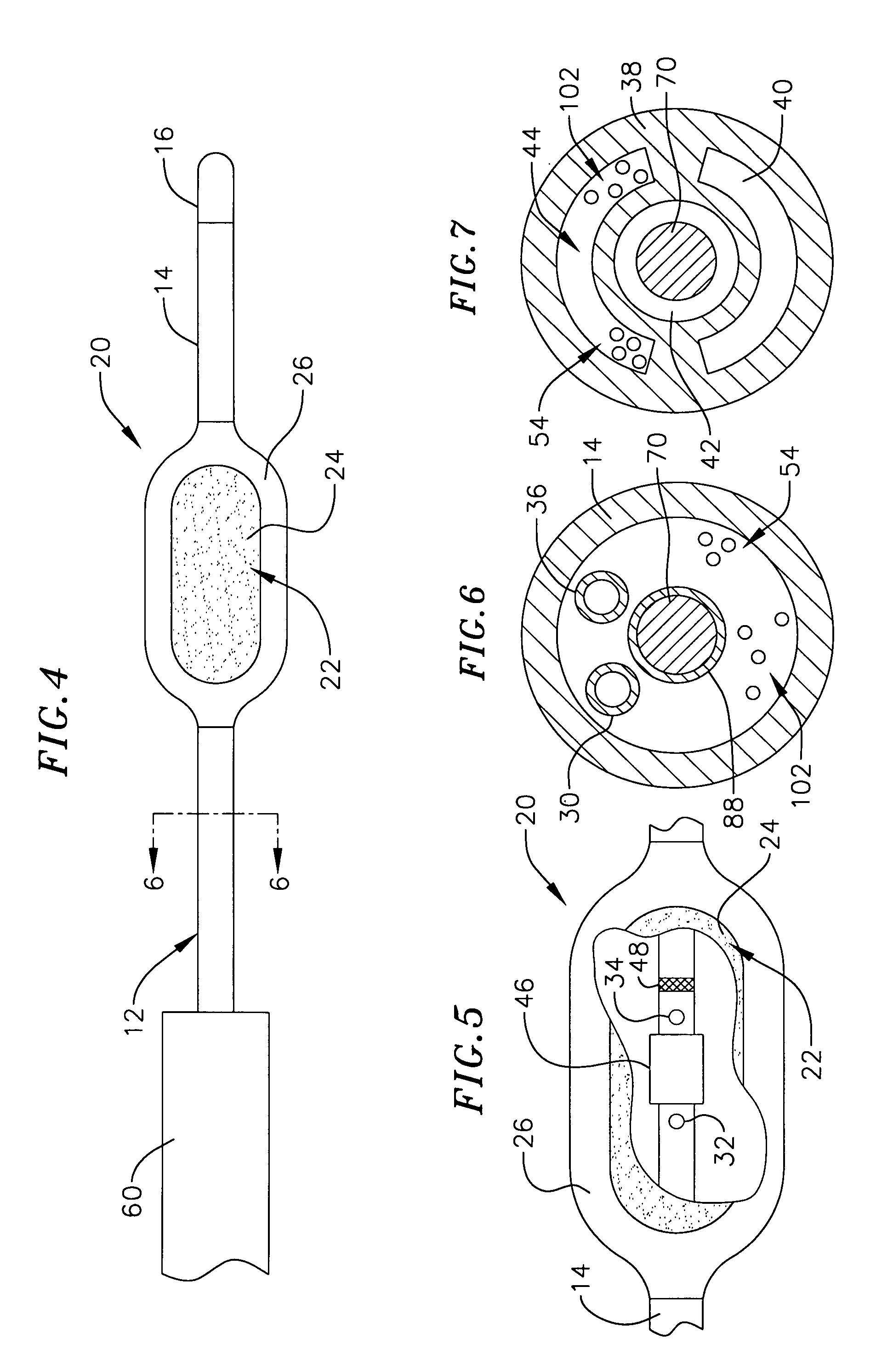 Loop structure including inflatable therapeutic device