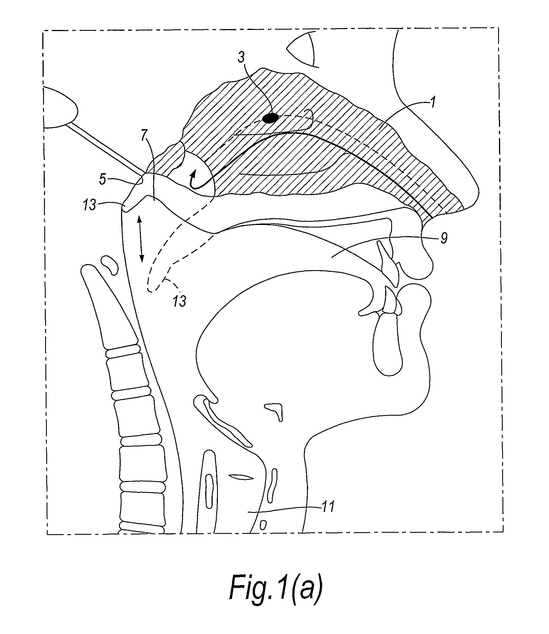 Nasal delivery