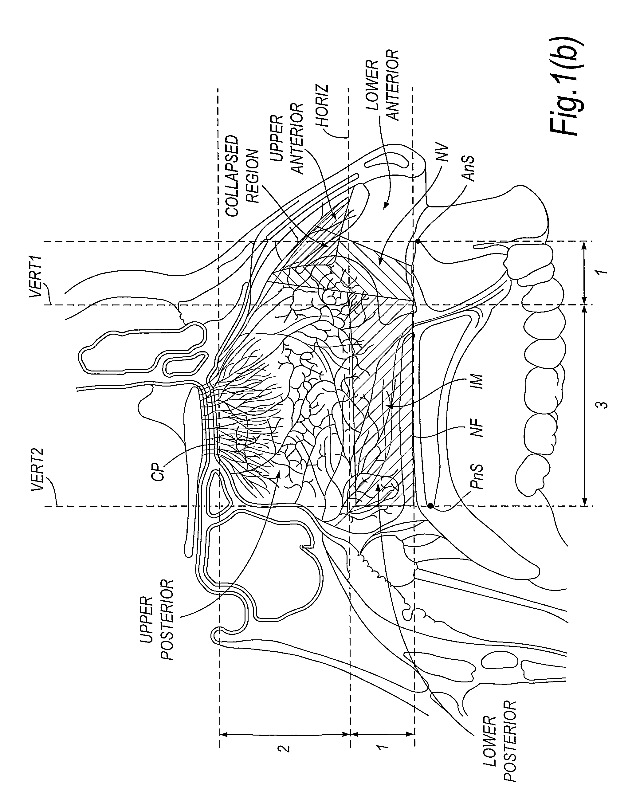 Nasal delivery