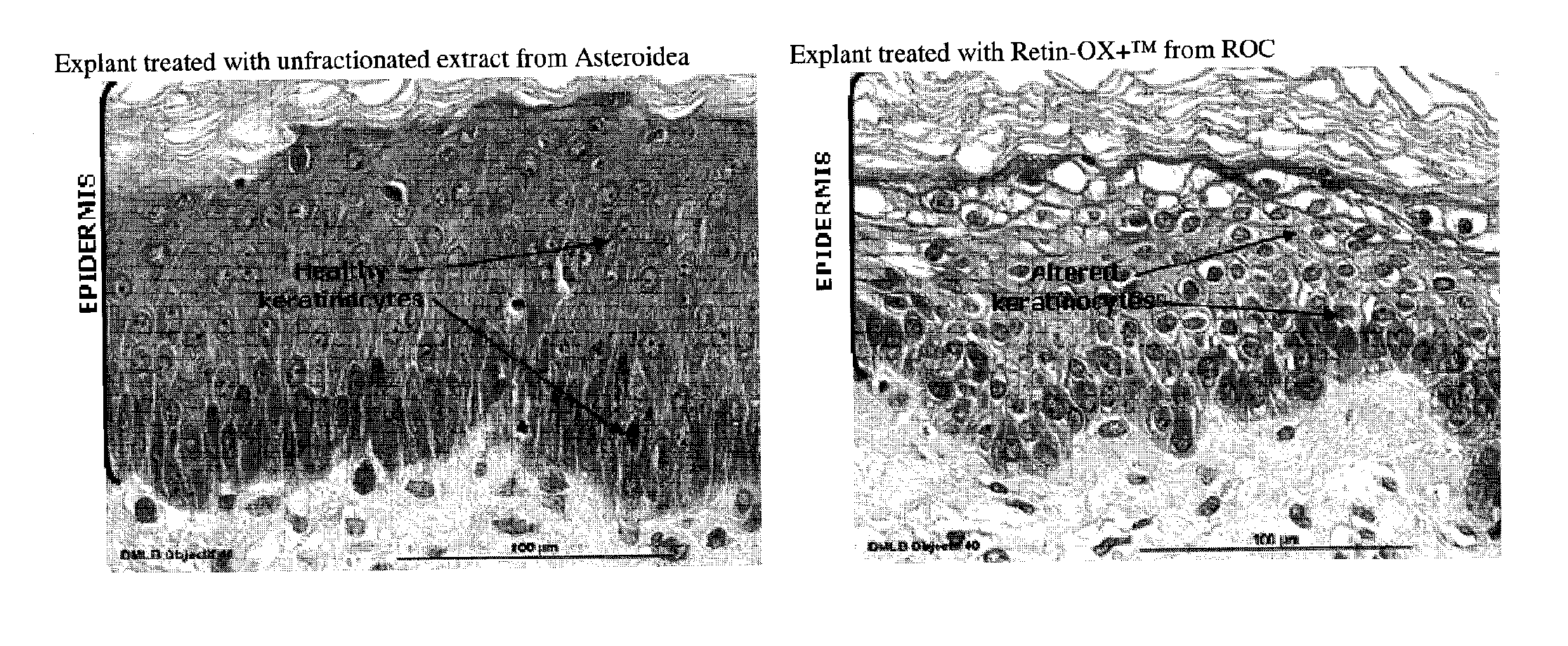 Cosmetic compositions comprising asteroidea body fluid and methods of use thereof