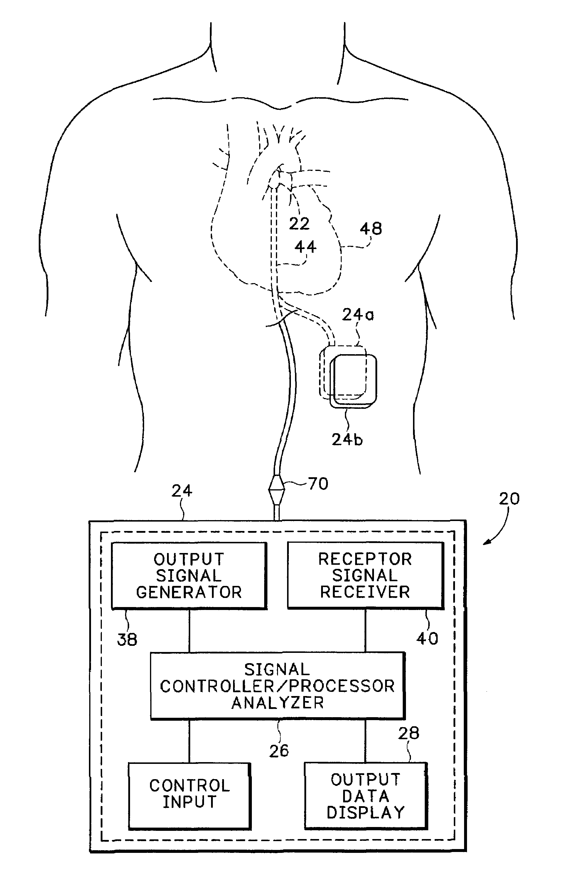 Method and apparatus for monitoring blood condition and cardiopulmonary function