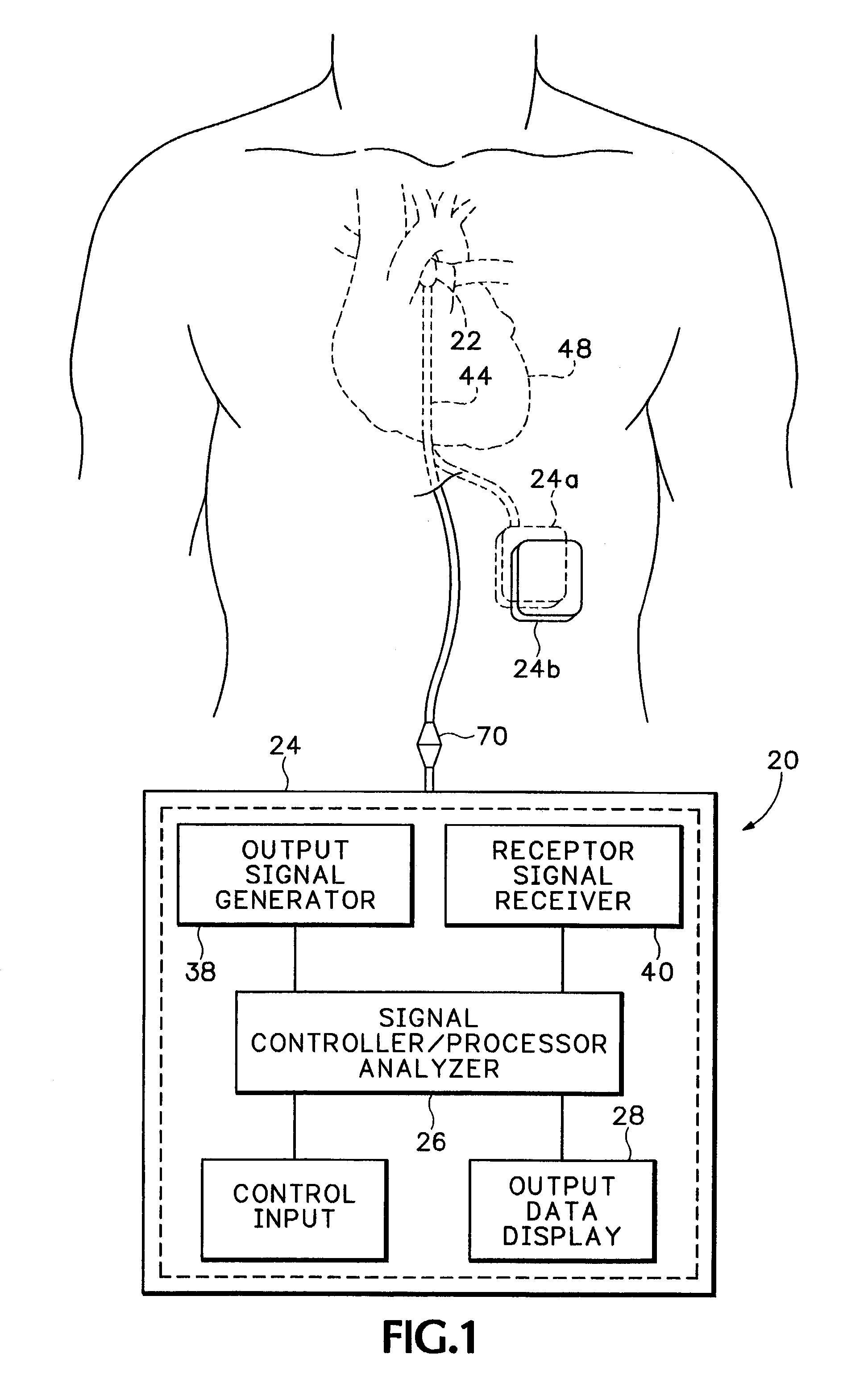 Method and apparatus for monitoring blood condition and cardiopulmonary function