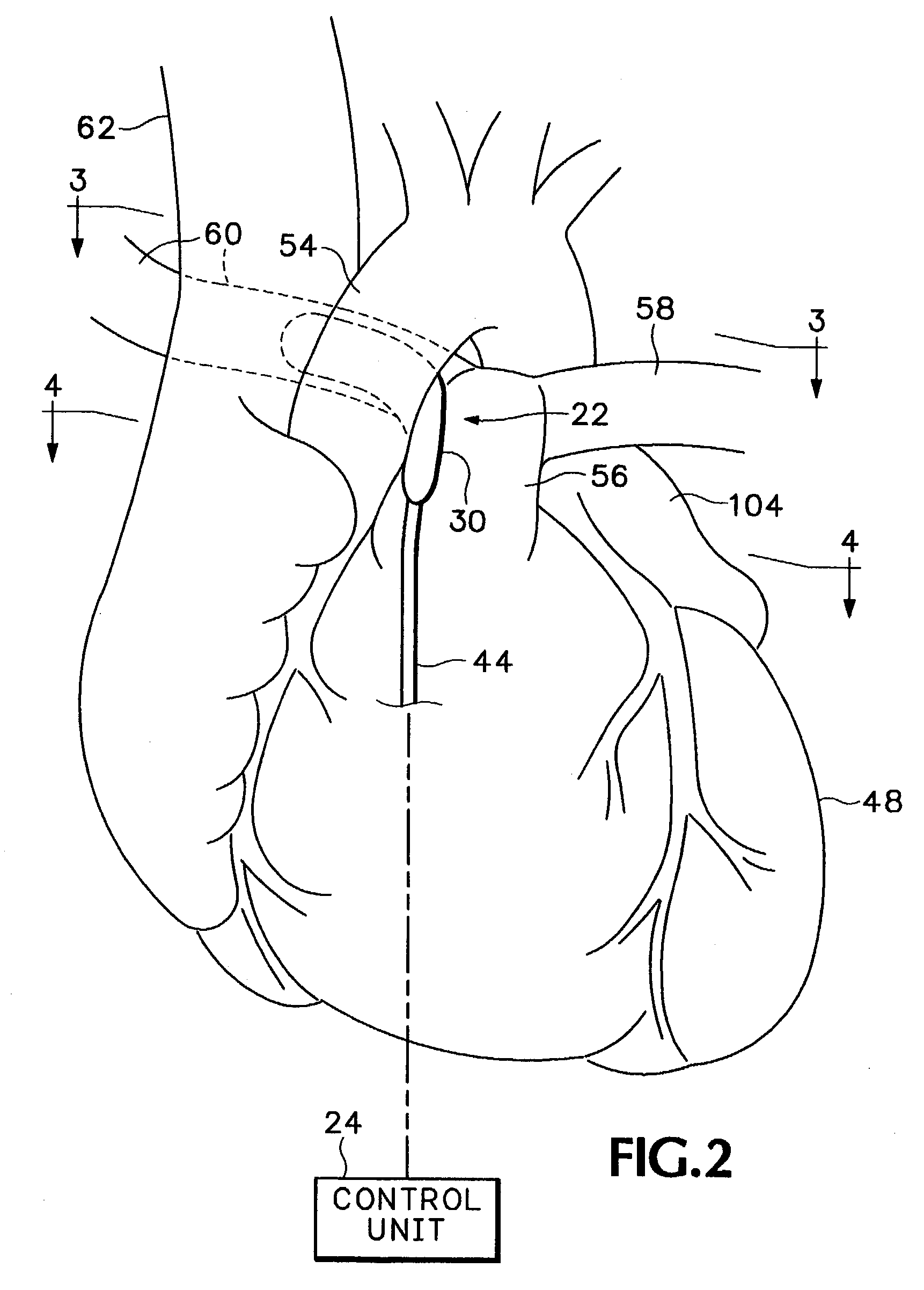 Method and apparatus for monitoring blood condition and cardiopulmonary function