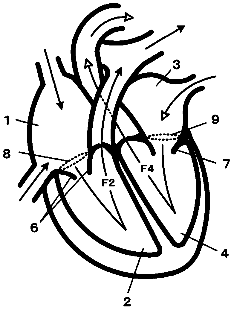 Left atrial pressure measuring method and left atrial pressure measuring device