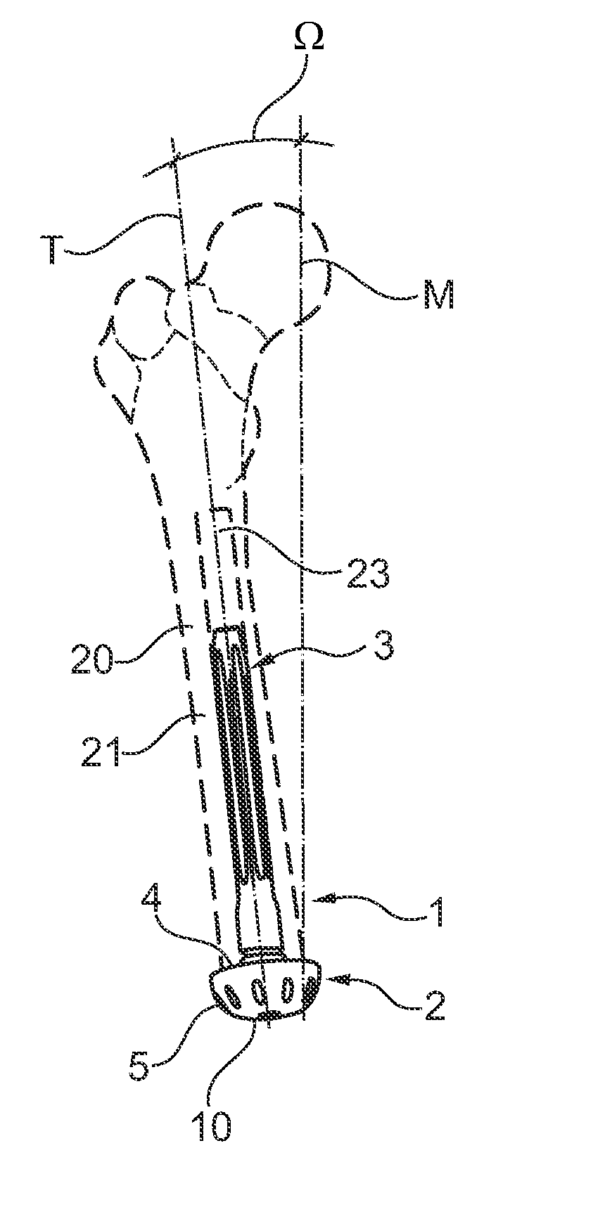 Implant for lower limb amputation