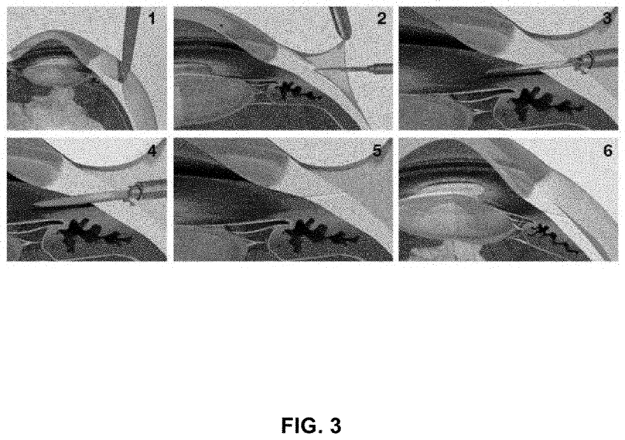 Methods, systems, and compositions for maintaining functioning drainage blebs associated with minimally invasive micro sclerostomy