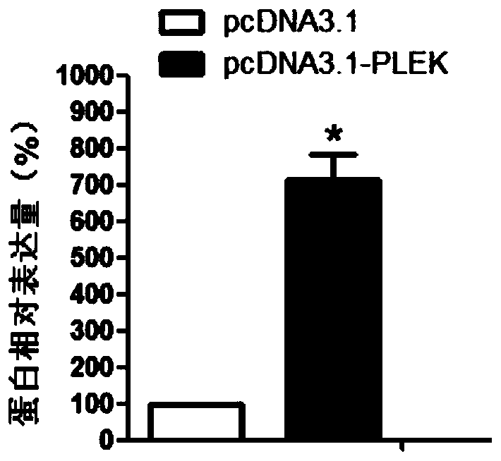 Genetic markers of preeclampsia