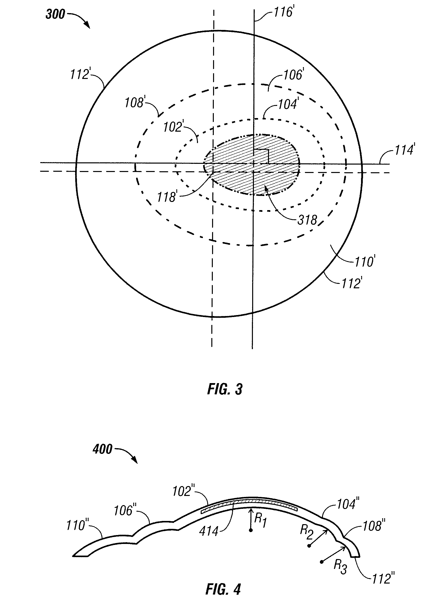 Contact lens for keratoconus