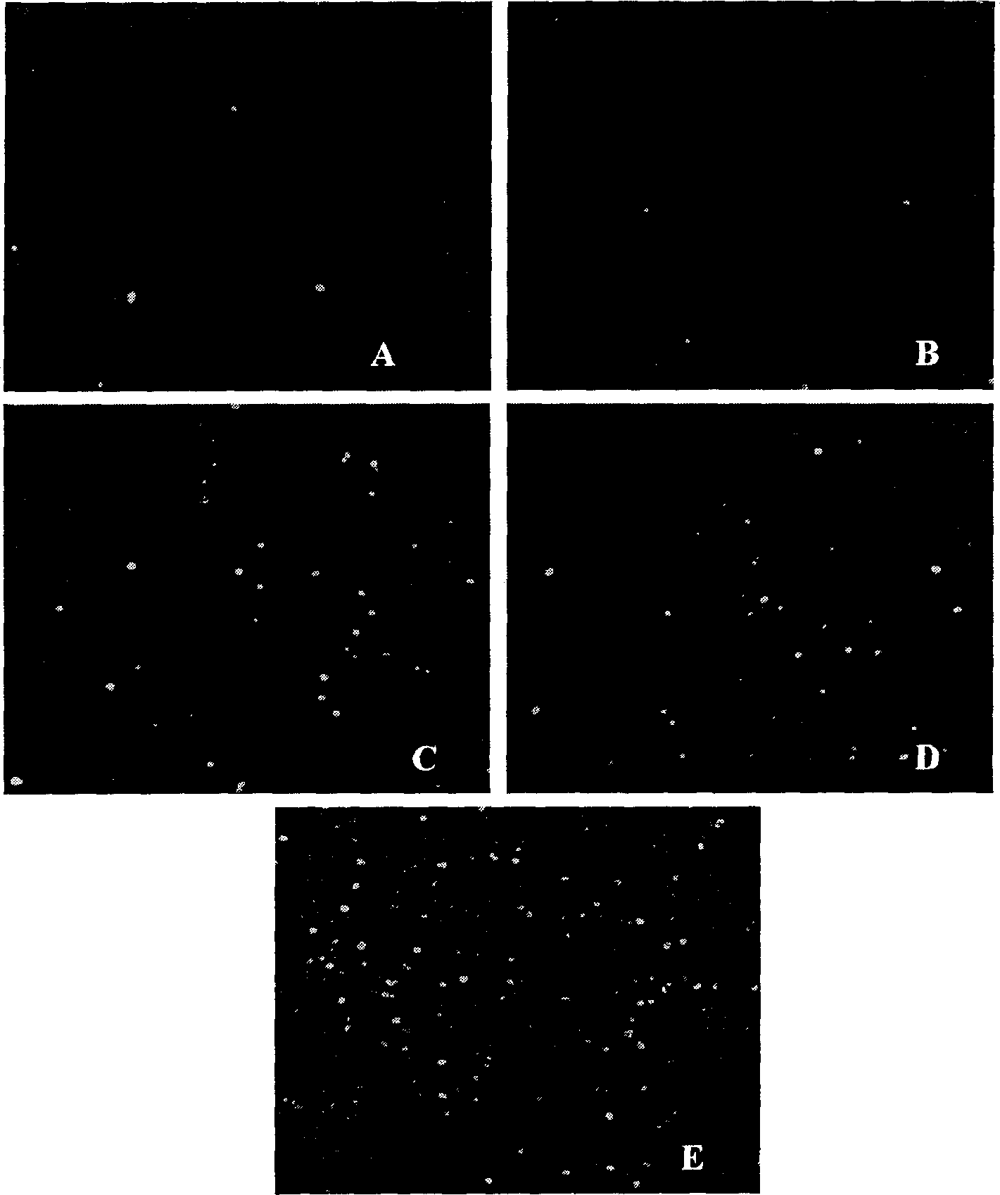 Officinal magnolia phenol lipid frozen dried powder preparation and its use in preparing drug for cancers