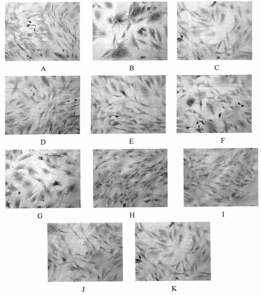 Drug composite for preventing diabetic nephropathy and preparation method thereof