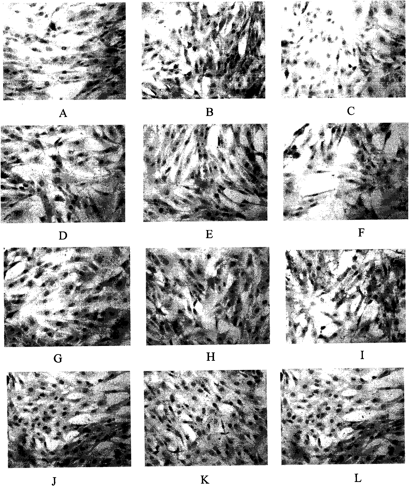 Drug composite for preventing diabetic nephropathy and preparation method thereof