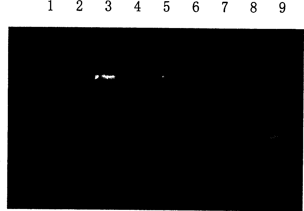 Rape pyruvic dehydrogenase kinase gene and its application in rape