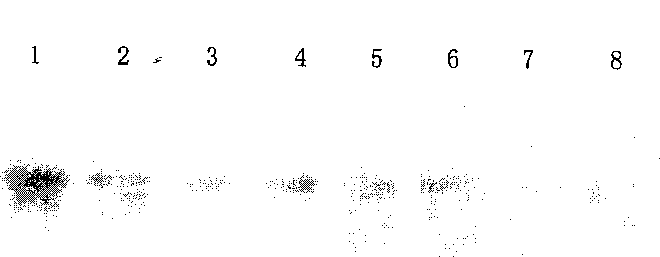 Rape pyruvic dehydrogenase kinase gene and its application in rape