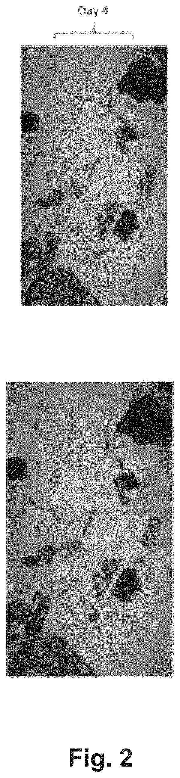 Methods for the production and use of myceliated high protein food compositions