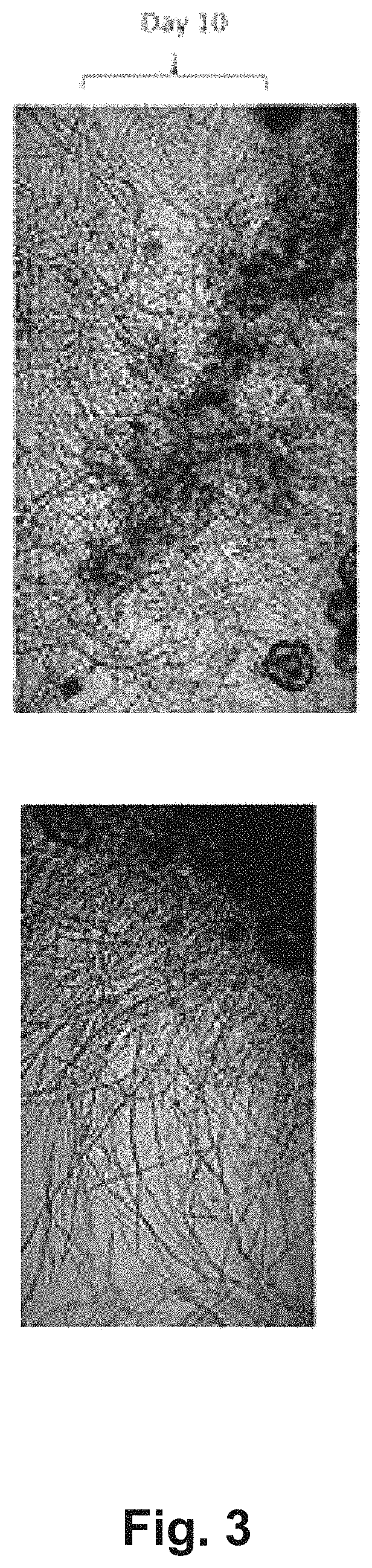 Methods for the production and use of myceliated high protein food compositions