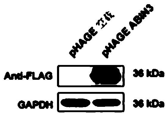 Application of nuclear factor kappa b inhibitory protein 3 combined with a20 in the preparation of drugs for treating fatty liver and related diseases