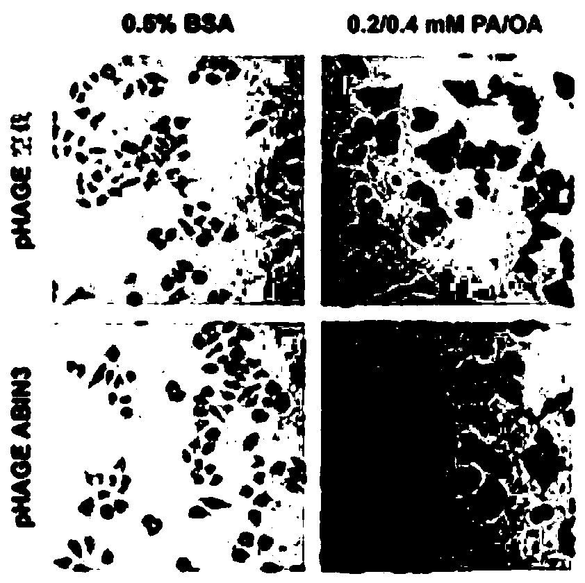 Application of nuclear factor kappa b inhibitory protein 3 combined with a20 in the preparation of drugs for treating fatty liver and related diseases