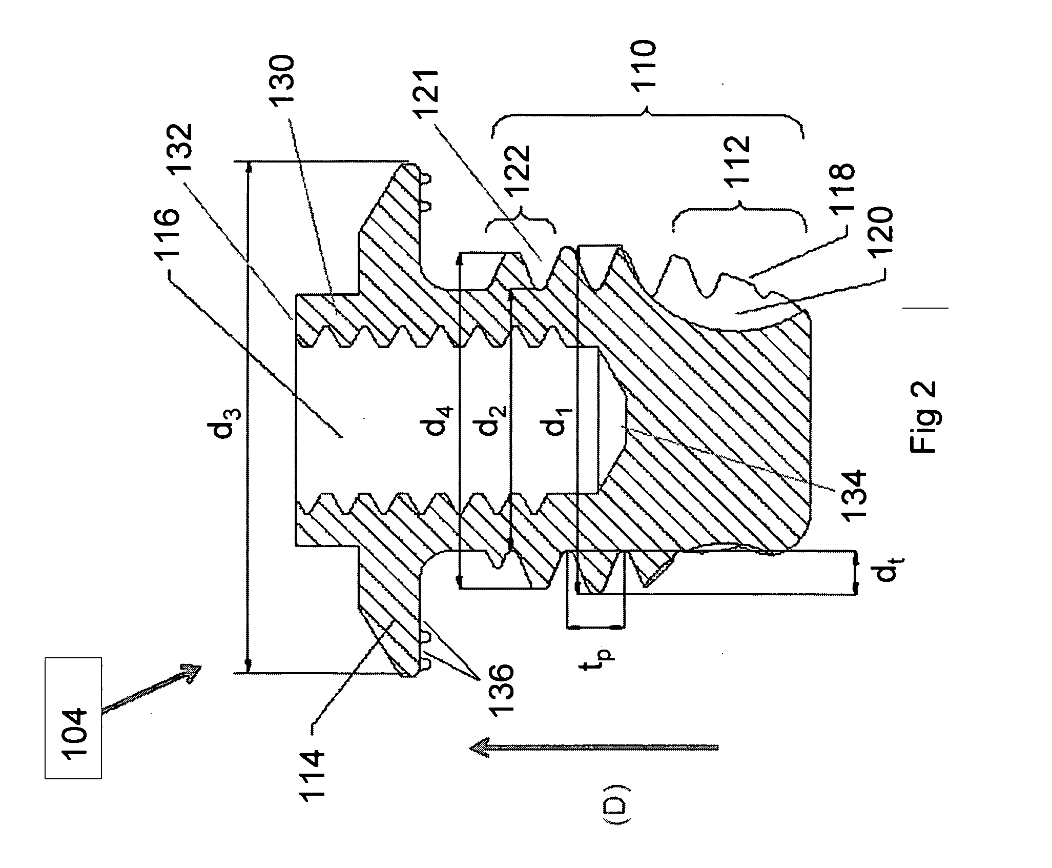 Hearing-aid anchoring element