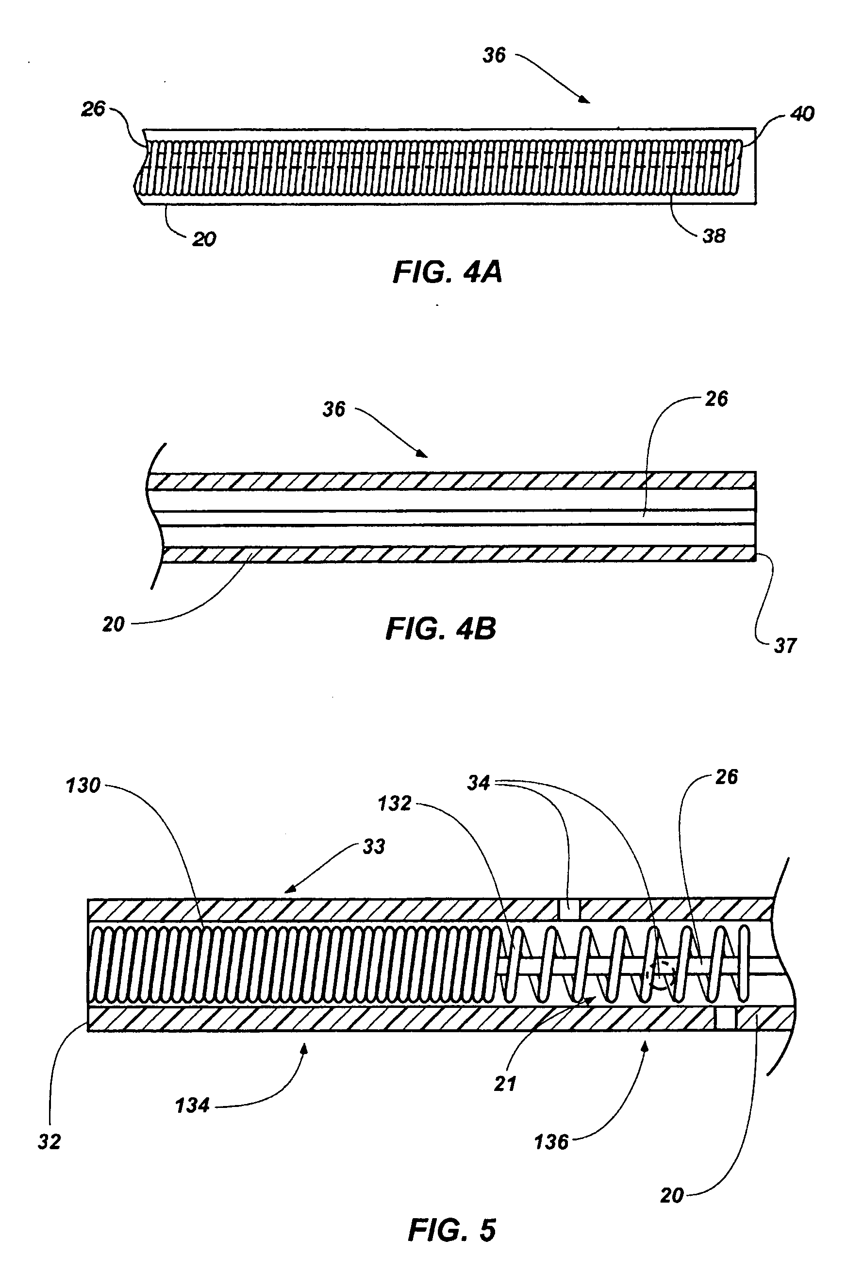 Ultrasound guided echogenic catheter and related methods