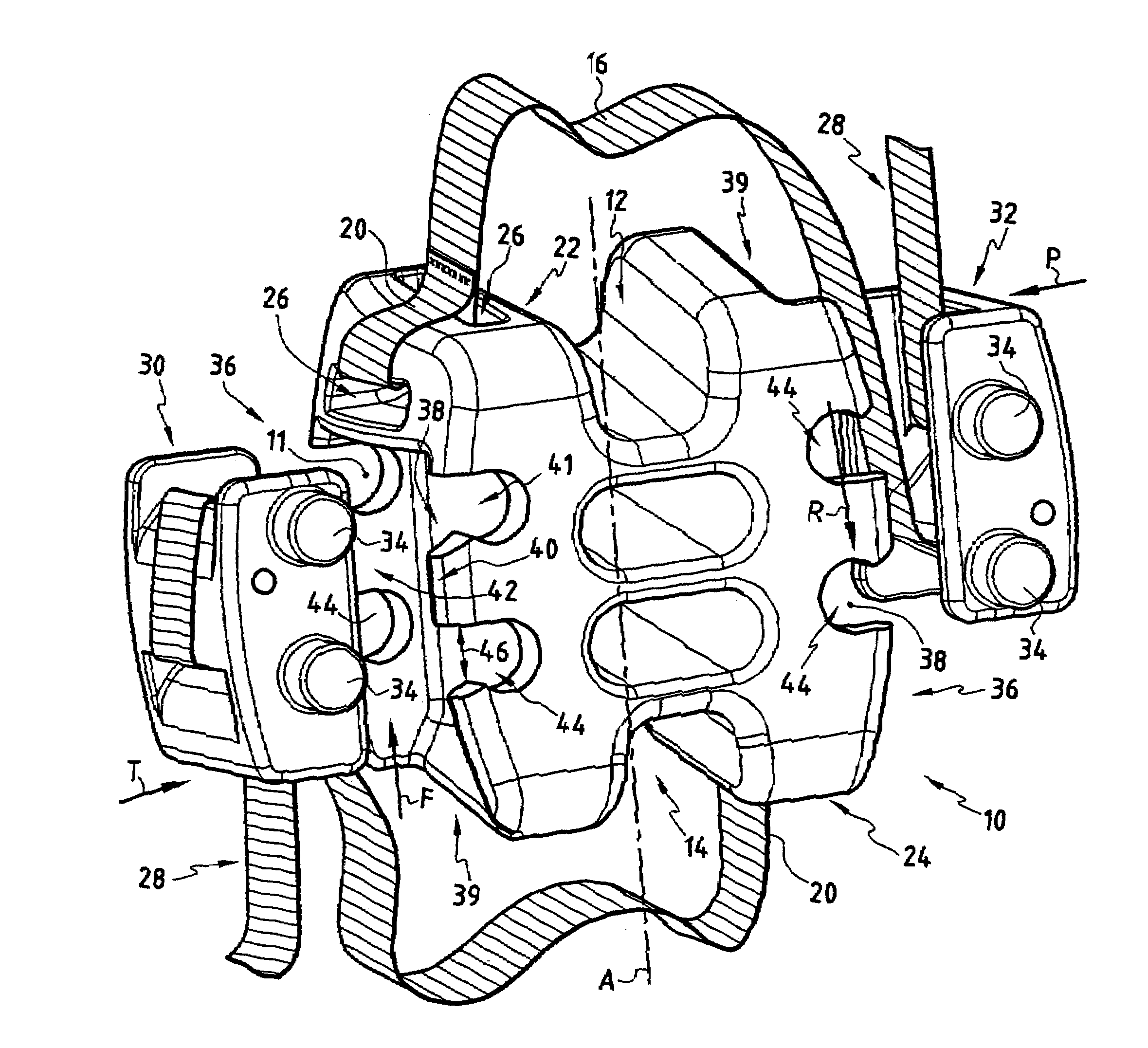 Self locking fixable intervertebral implant