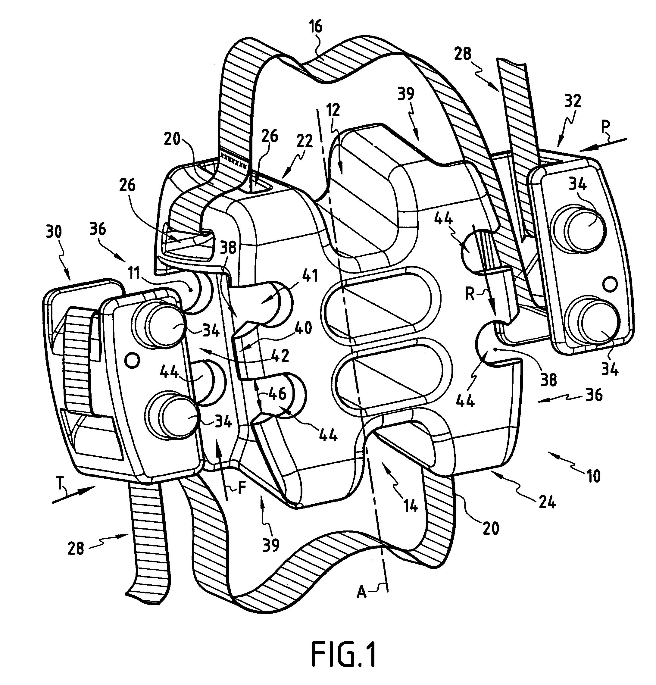 Self locking fixable intervertebral implant