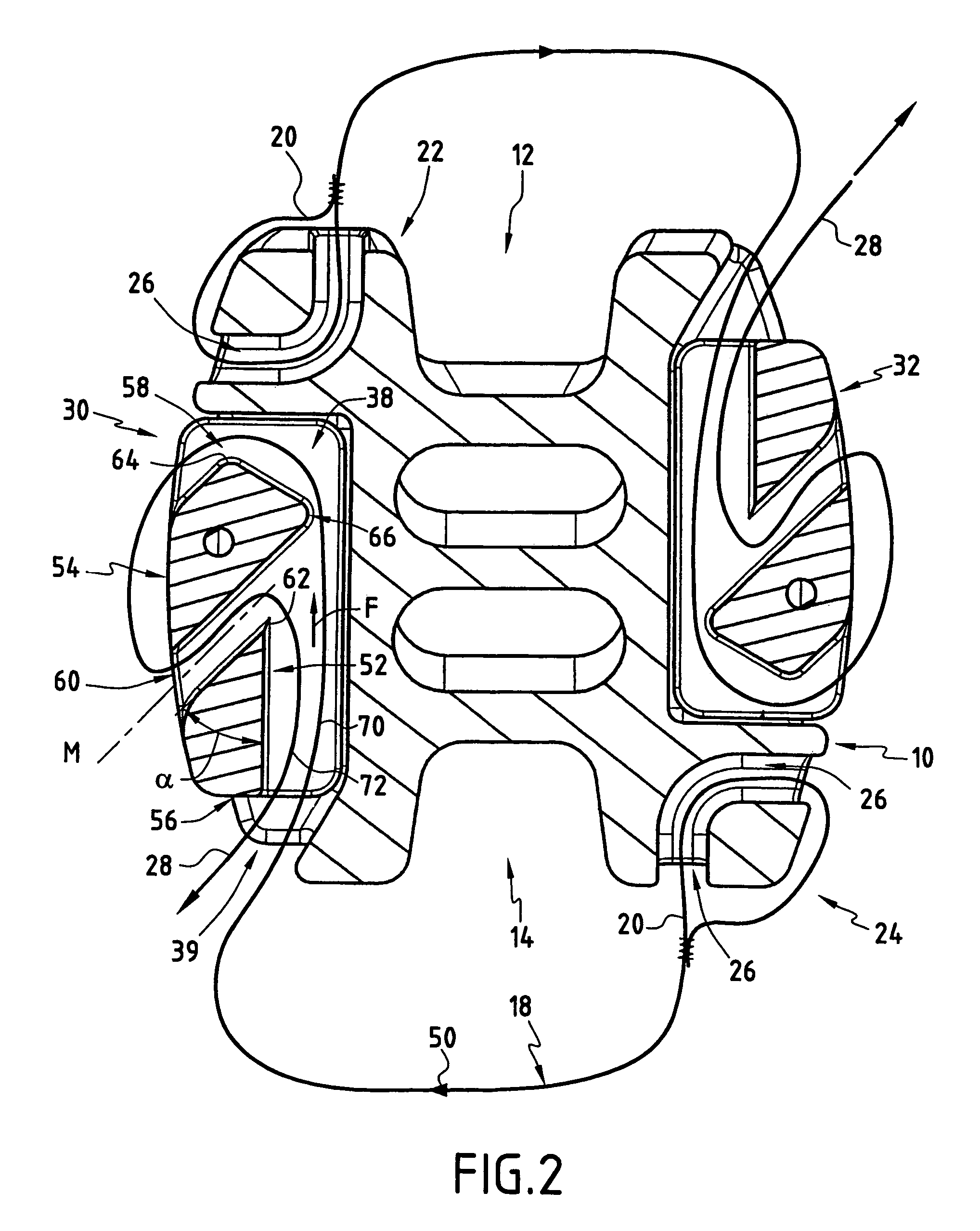 Self locking fixable intervertebral implant